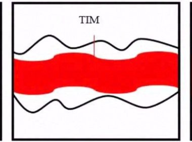 低迁移绝缘导热硅脂界面材料的制备及其性能研究